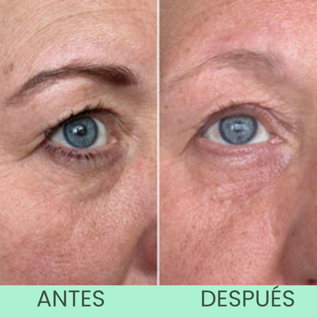 WildMint™ Crema Iluminadora de Ojos