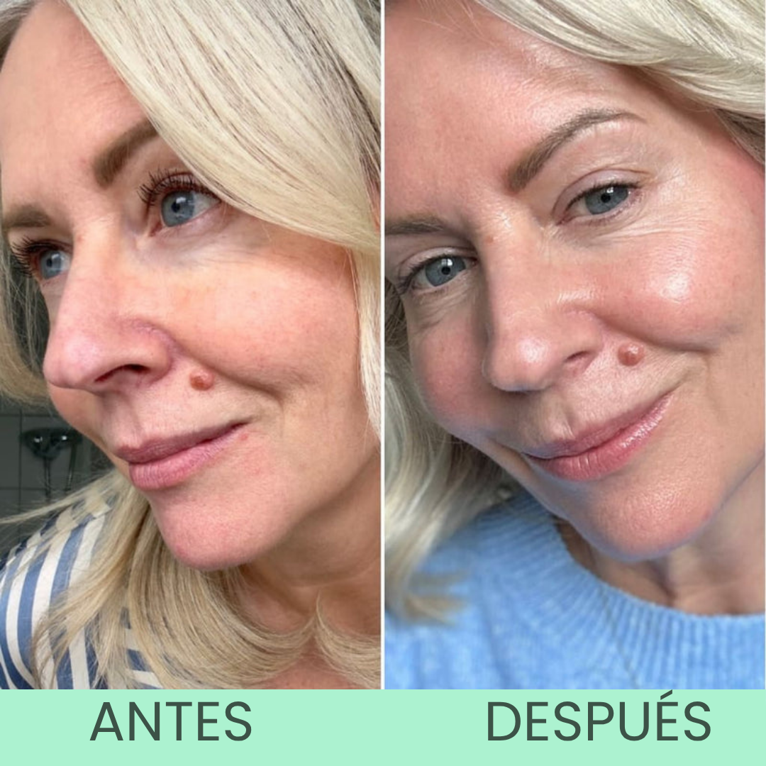 WildMint™ Crema Iluminadora de Ojos